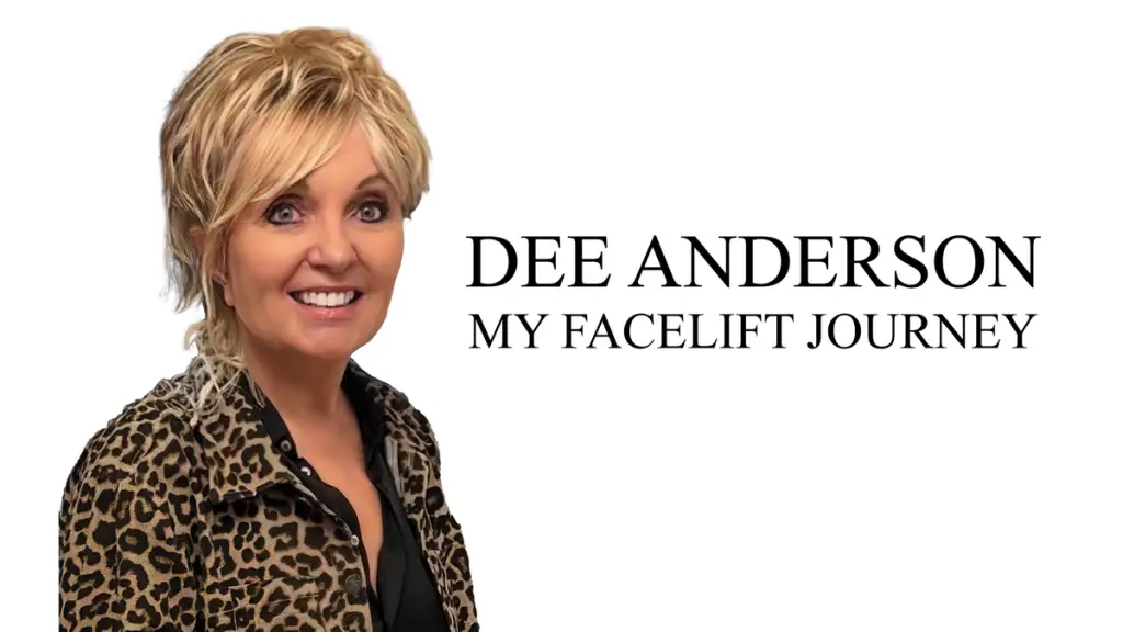 Dee Anderson: My Facelift Journey poster