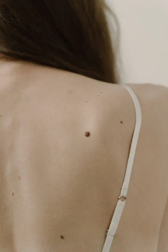 Skin on a woman's back