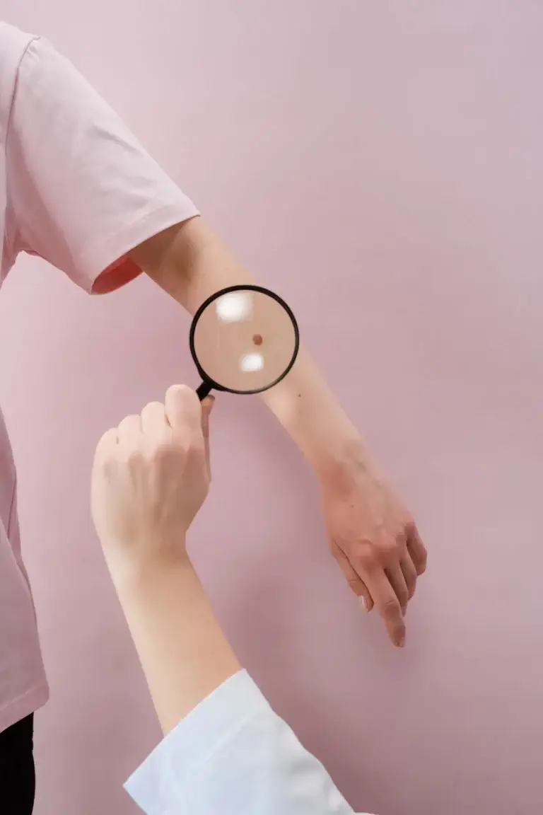 BCC vs SCC: what is the difference between these skin cancers?